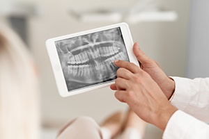 Digital dental x-rays on tablet computer