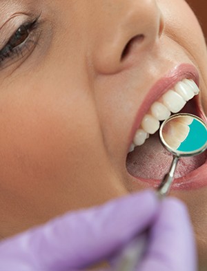 Patient's smile during dental exam